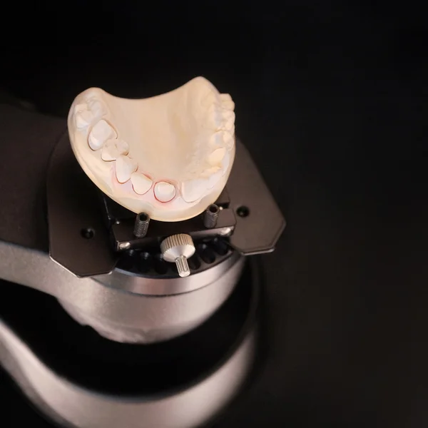 Artificial dentures made in dental laboratory