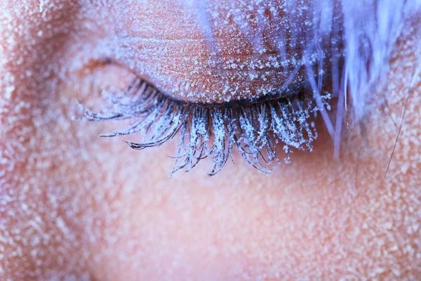 Frozen woman's eye