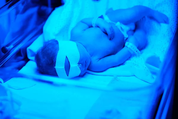 Newborn baby under blue UV light