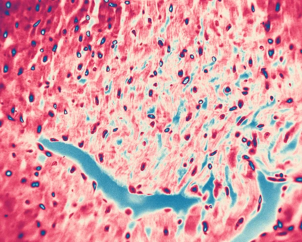 Dog cardiac muscle