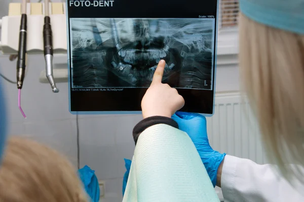 The doctor showing baby foto dent