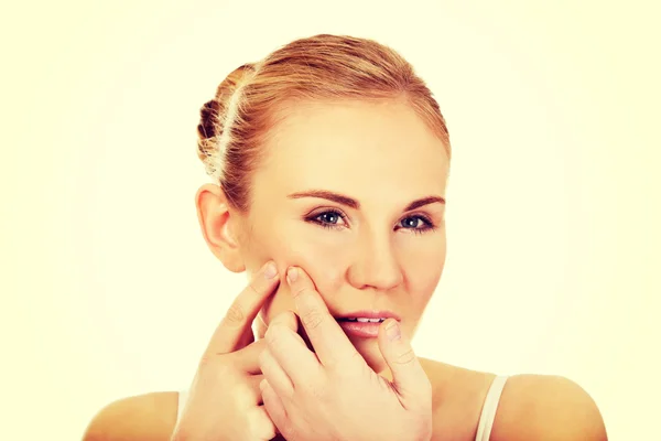 Unhappy young woman squeezing pimple on face