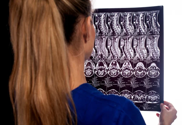 MRI diagnostics of cervical spine