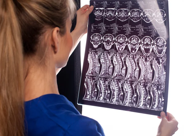 MRI diagnostics of cervical spine