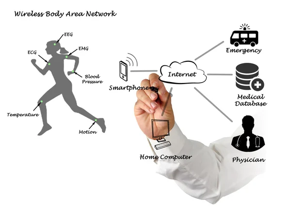 Diagram of telemedicine