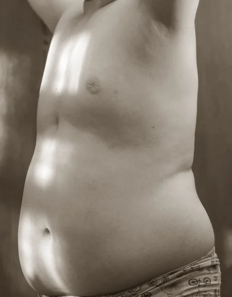Childhood obesity boy 12 years the body of the stomach. metaboli
