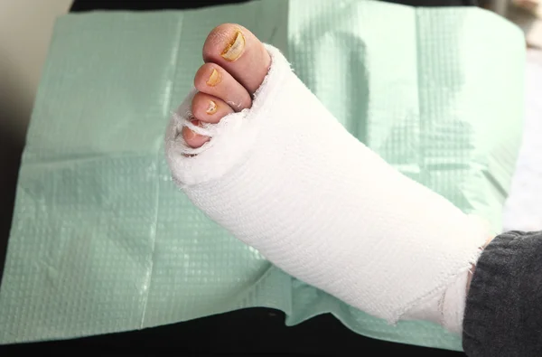 Diabetic man with foot infections