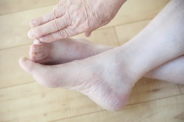 Mature man reaching for toes