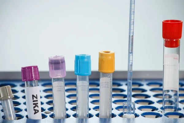 Test tube for analyzing ZIKA virus