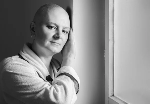 Bald woman suffering from cancer