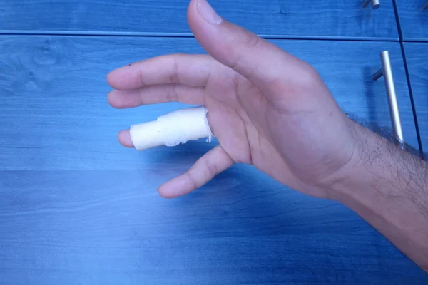 Injured painful male hand finger
