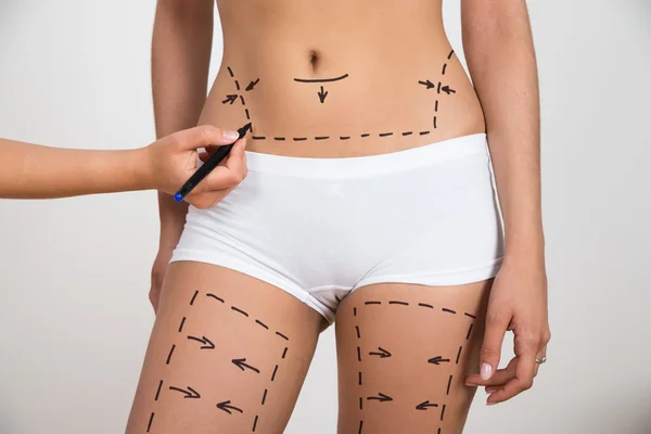 Hand Drawing Lines On Abdomen