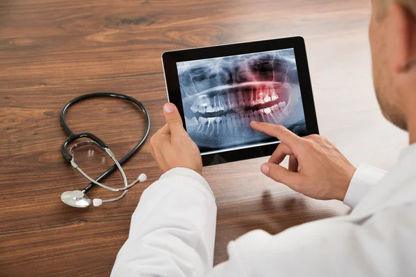 Doctor with Human Teeth X-ray