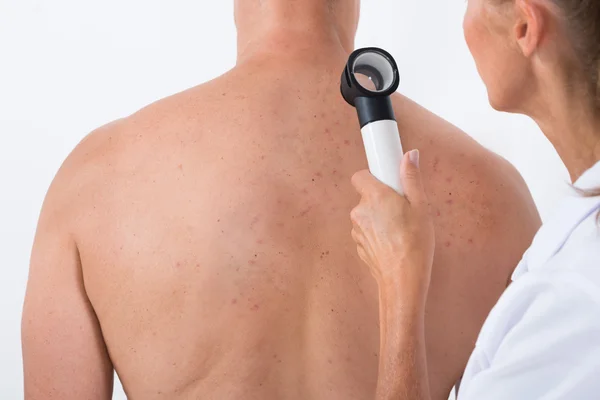 Doctor Examining Acne Skin