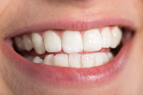 Woman Showing Healthy White Teeth