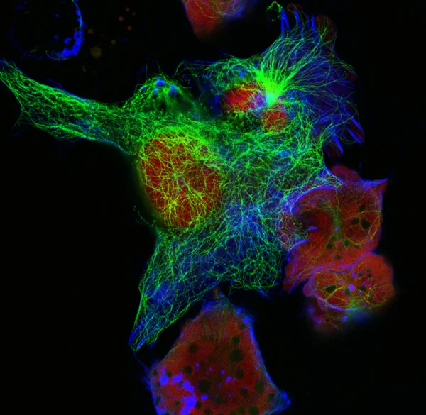 Real fluorescence microscopic view of mice neuroblastoma cell line