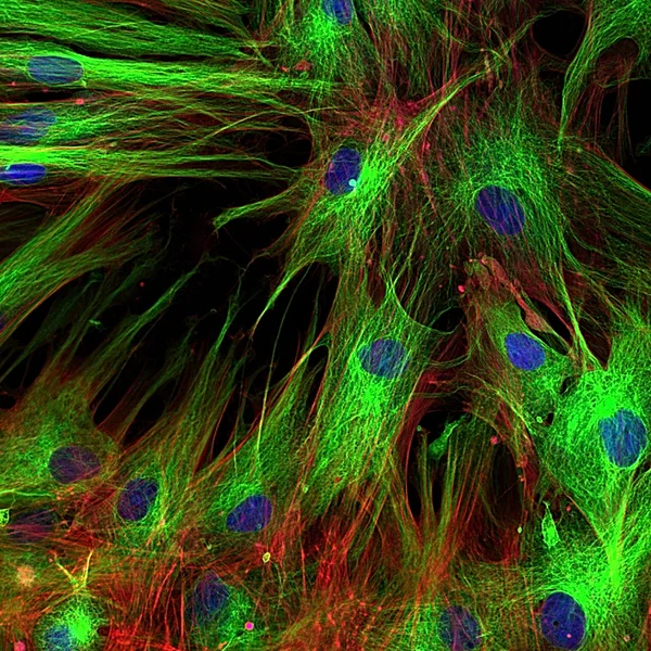 Fibroblasts (skin cells) labeled with fluorescent dyes