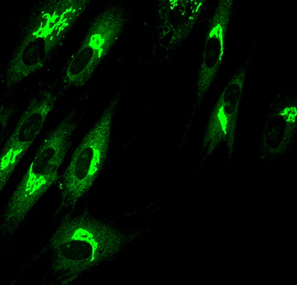 Golgi complex in fibroblasts (skin  cells) labeled with fluorescent dyes