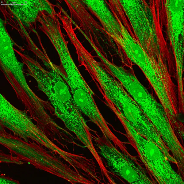 Fibroblasts (skin  cells) labeled with fluorescent dyes