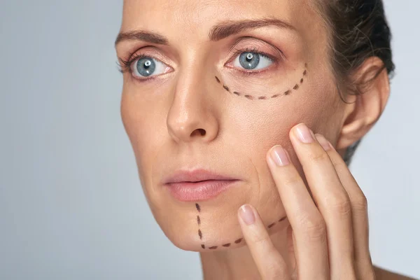 Perforation drawing lines on woman's face before procedure