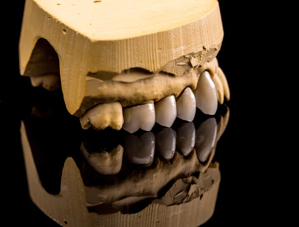 False teeth, dental concept