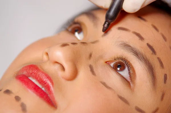 Closeup young womans face preparing for cosmetic surgery with lines drawn on skin, doctor measuring using red tool, as seen from above