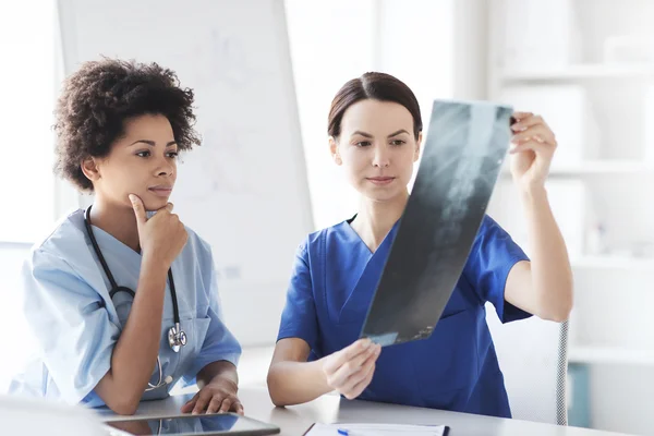 Female doctors with x-ray image at hospital