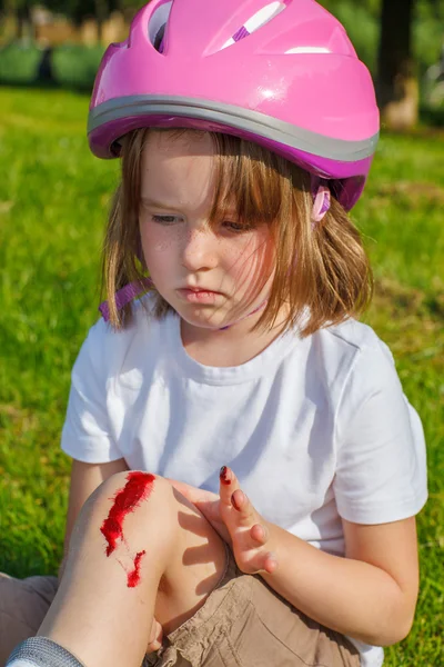 Unhappy girl with her knee bleeding