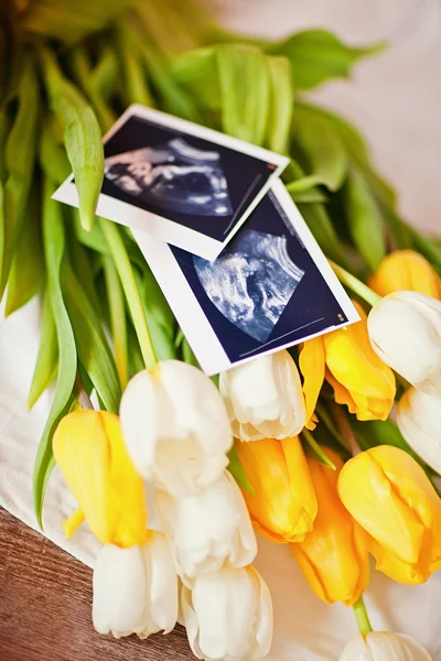 Photo of an ultrasound sonogram of an unborn baby with bouquet o