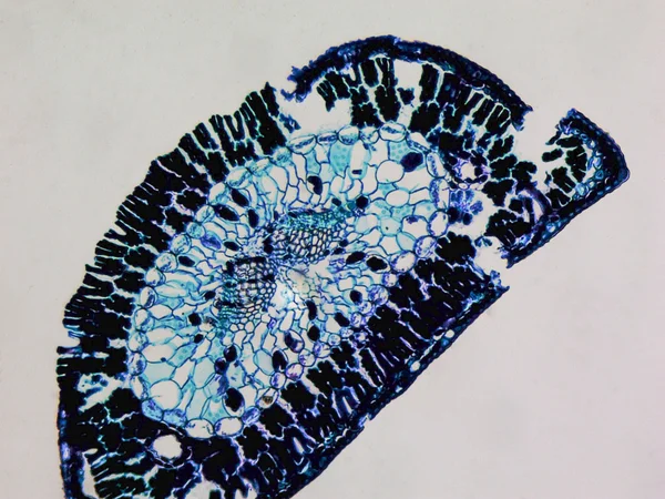 Pine leaf micrograph
