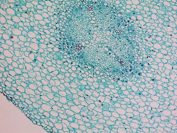 Vicia faba root micrograph
