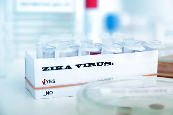 Micro tubes with  Blood sample positive with Zika virus