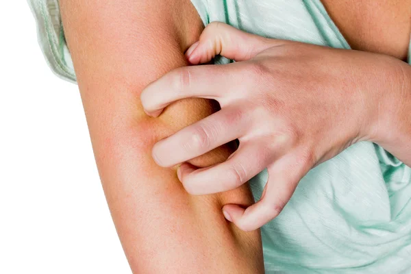 Immunomodulyatory en el tratamiento de la psoriasis