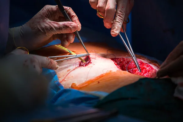 Surgery in a modern hospital close up