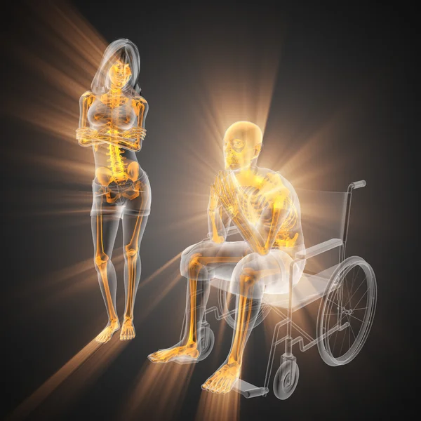 Radiography of man in wheelchair