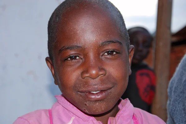 The skin of a child sick with AIDS