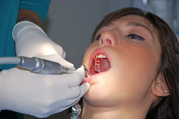 Dental Care - A girl at the dentist