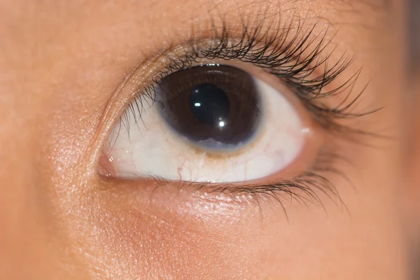 Eye exam, congenital corneal problem