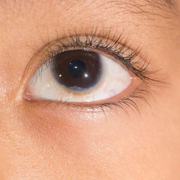 Eye exam, congenital corneal problem