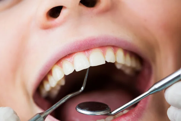 Close-up of female with open mouth during oral checkup at the dentist