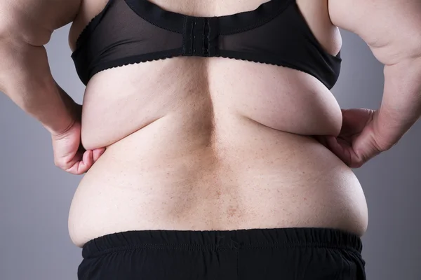 Obesity female body, fat woman back in black lingerie