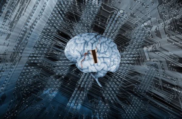 Artificial intelligence, human brain and micro-chips