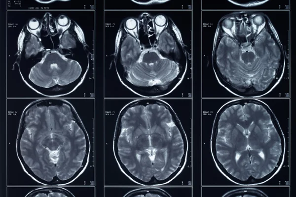 X-ray head and brain radiography