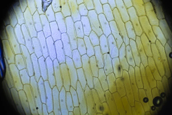Mitosis. Epithelial cells Onion skin