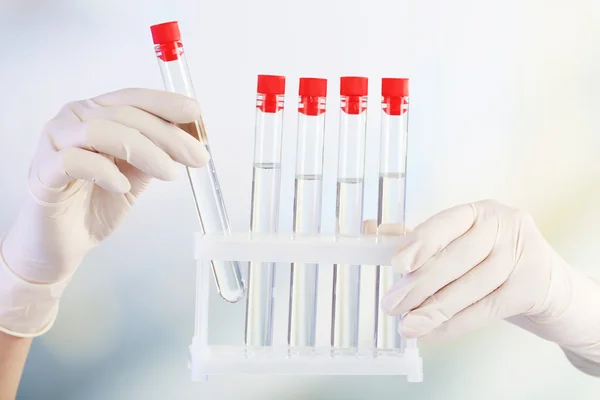 Hands holding test tubes on light background