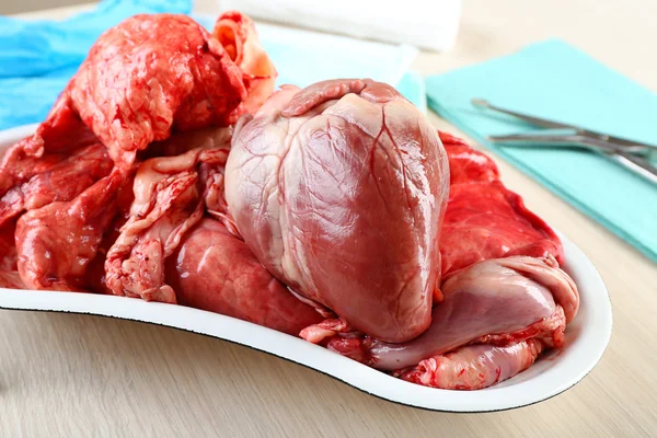 Heart organ in medical metal tray