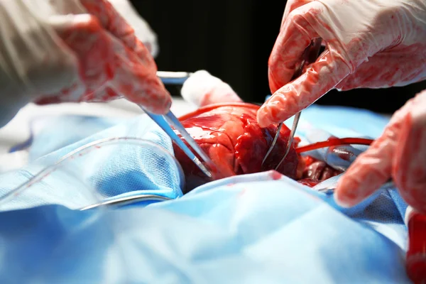 Doctor doing heart operation