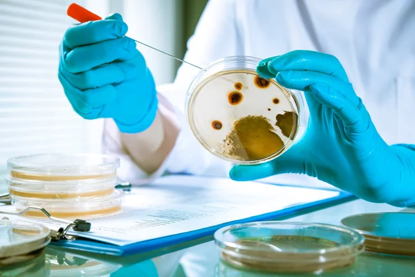 Agar plate with growing germs