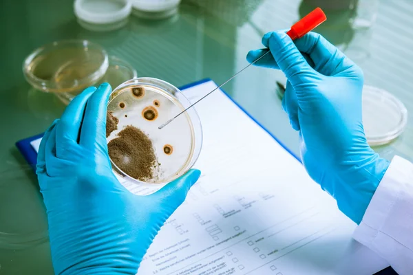 Agar plate with growing germs