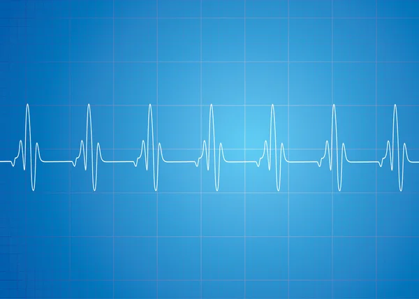 Heart Beat On Blue Background